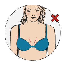 You Have Discomfort at the Sides of Your Breasts