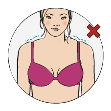 Bra Straps are Leaving Sore, Red Marks